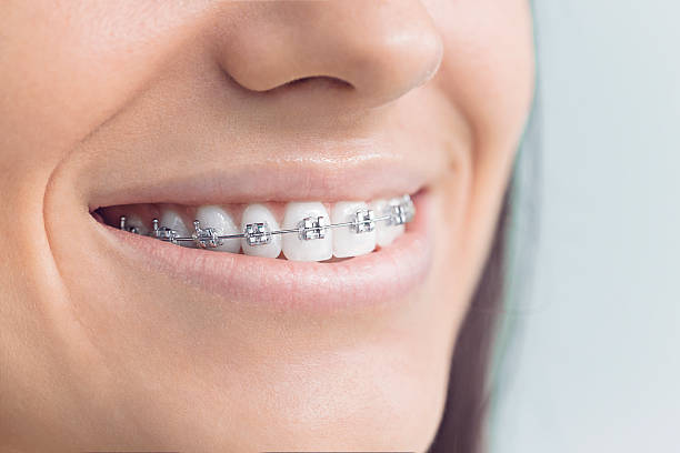 Best Traditional Braces  in Pinetops, NC